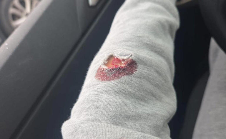 Balean a funcionaria de Tecámac, Estado de México