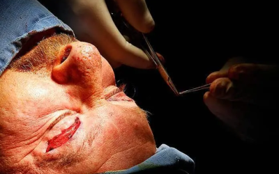 Muere hombre tras realizarse cirugía estética en NL
