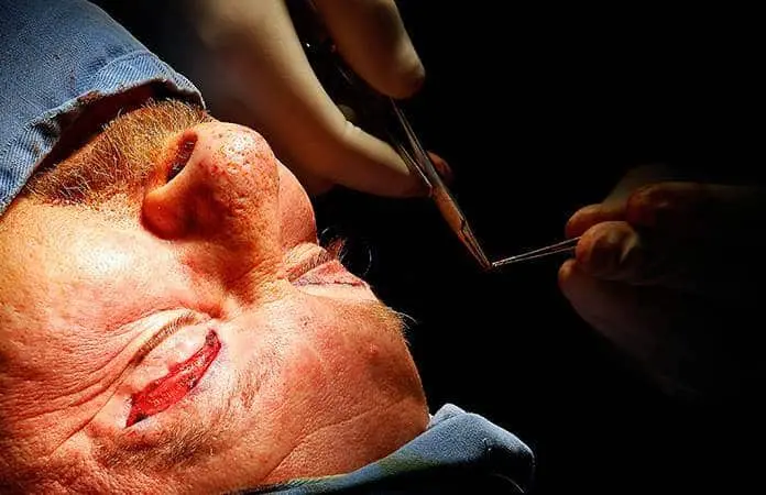 Muere hombre tras realizarse cirugía estética en NL