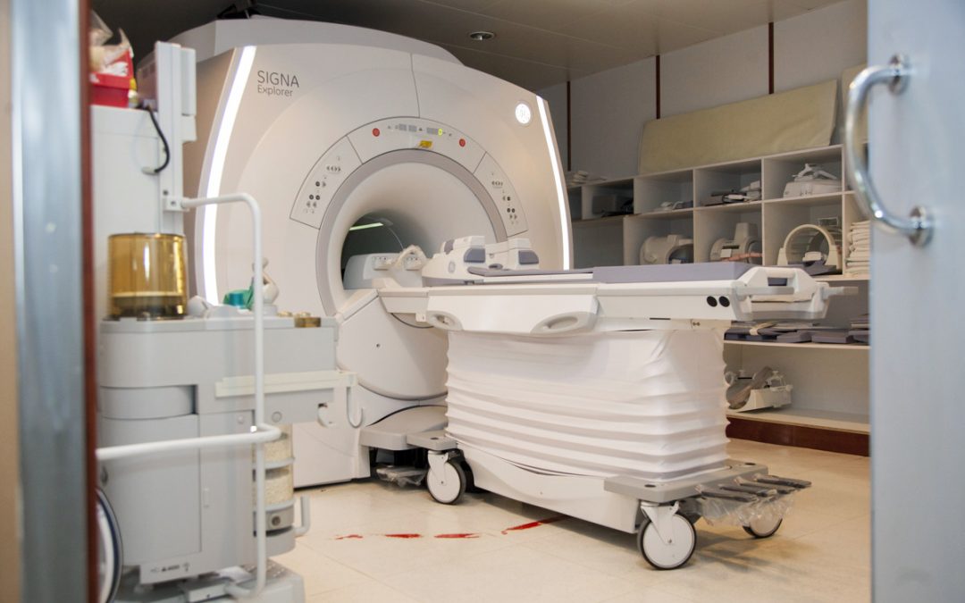 No siempre las resonancias cuentan la verdad sobre el cerebro, según un estudio