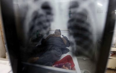 Dos casos de tuberculosis en el mayor centro de detención para migrantes de EE.UU.
