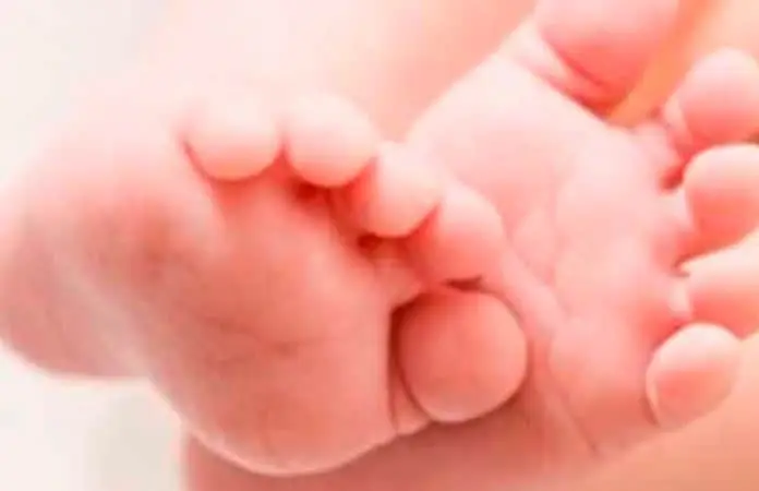 Confirman contagio de sarampión en un bebé de Morelos