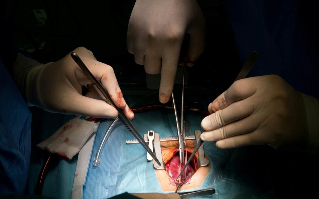 Pacientes trasplantadas piden combatir tabúes que frenan la donación de órganos en México