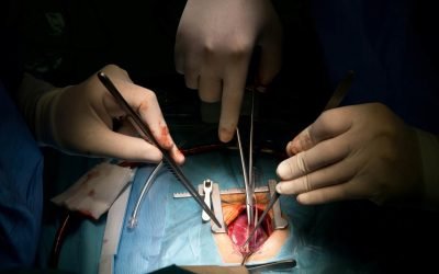 Pacientes trasplantadas piden combatir tabúes que frenan la donación de órganos en México