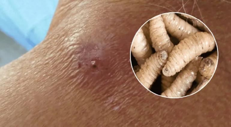 Registran primer fallecimiento por gusano barrenador en México