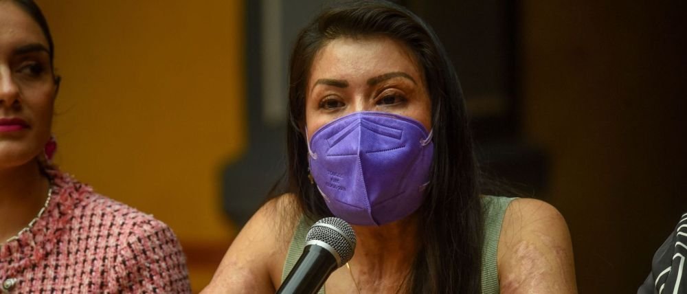 SCJN rechaza atraer revisión de amparos por ataque con ácido contra María Elena Ríos