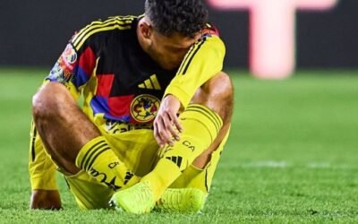 Sebastián Cáceres sufre fractura en el pómulo y es duda para la vuelta