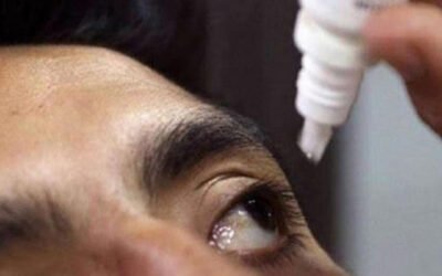 Aumentan contagios de conjuntivitis en Yucatán; suman más de 7 mil casos en lo que va del año