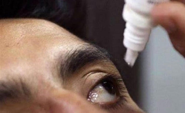 Aumentan contagios de conjuntivitis en Yucatán; suman más de 7 mil casos en lo que va del año